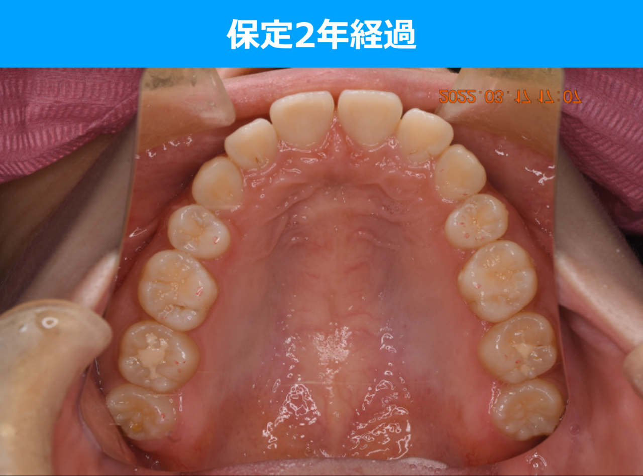 保定期間の写真