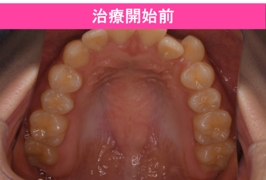 これで解決!矯正トラブル : マウスピース型矯正、MTM、再治療等の\"困った\"… これで解決!矯正トラブル : マウスピース型矯正、MTM、再治療等